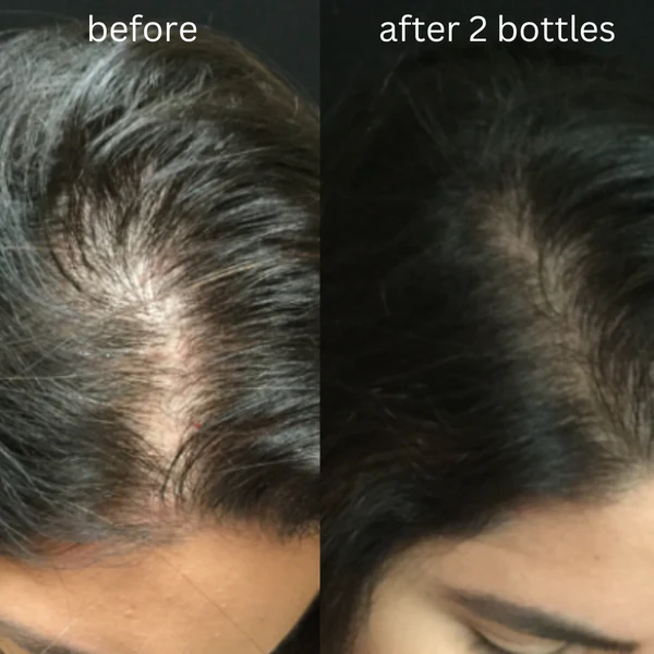🌿 Alif Ahlam Hair Oil